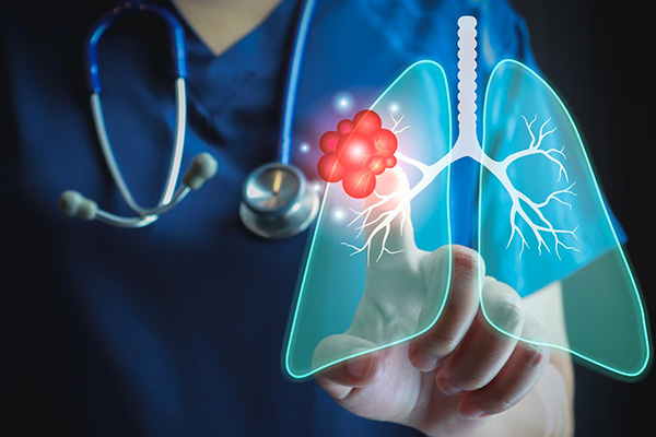 Cost of Liver Cancer Treatment