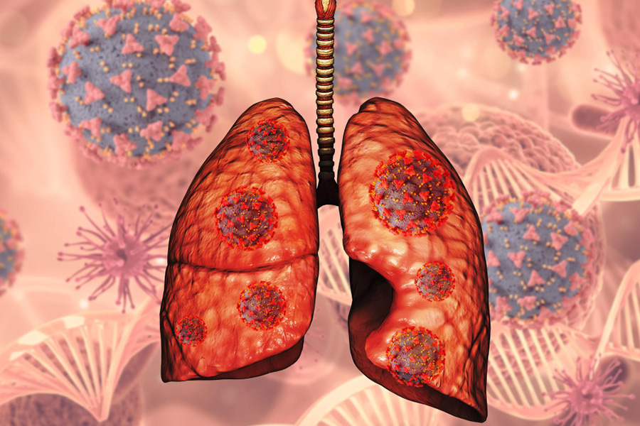 Lung Cancer Consultation