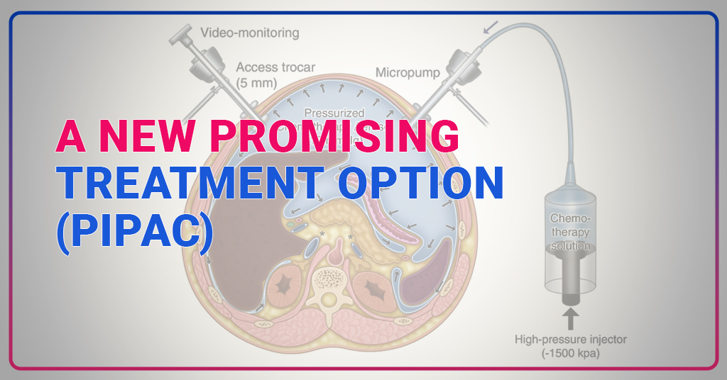 A new promising treatment option (PIPAC)