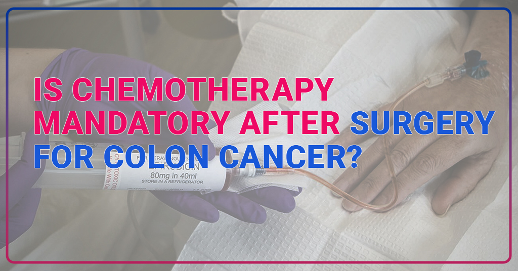 Is chemotherapy mandatory after surgery for colon cancer?